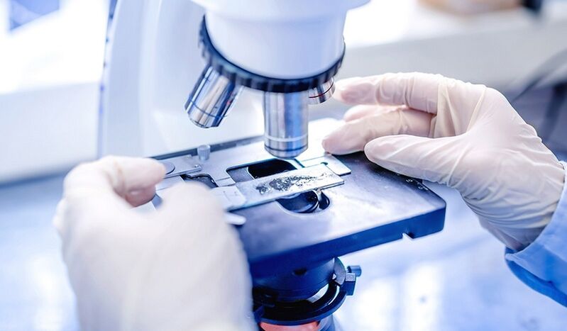 diagnóstico de laboratorio de hongos en las uñas de los pies