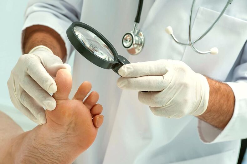dermatólogo examinando las uñas de los pies