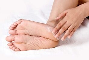tratamiento de hongos en la piel de los pies con crema