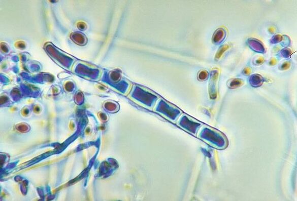 Hongo Trichophyton rubrum bajo un microscopio