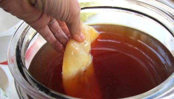 Kombucha para tratar hongos en las uñas