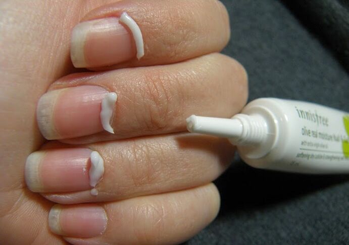 tratamiento de hongos en las uñas con ungüento