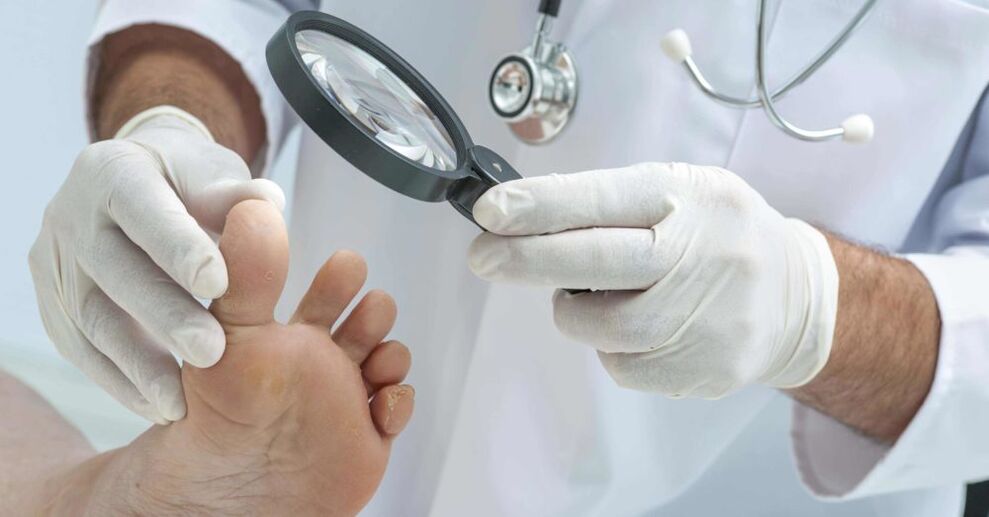 El médico examina los pies en busca de hongos.