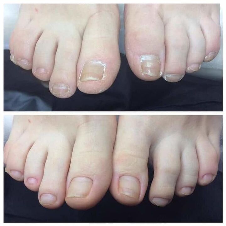 revisión de uso Exodermin